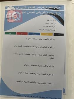 هيونداي أكسنت
